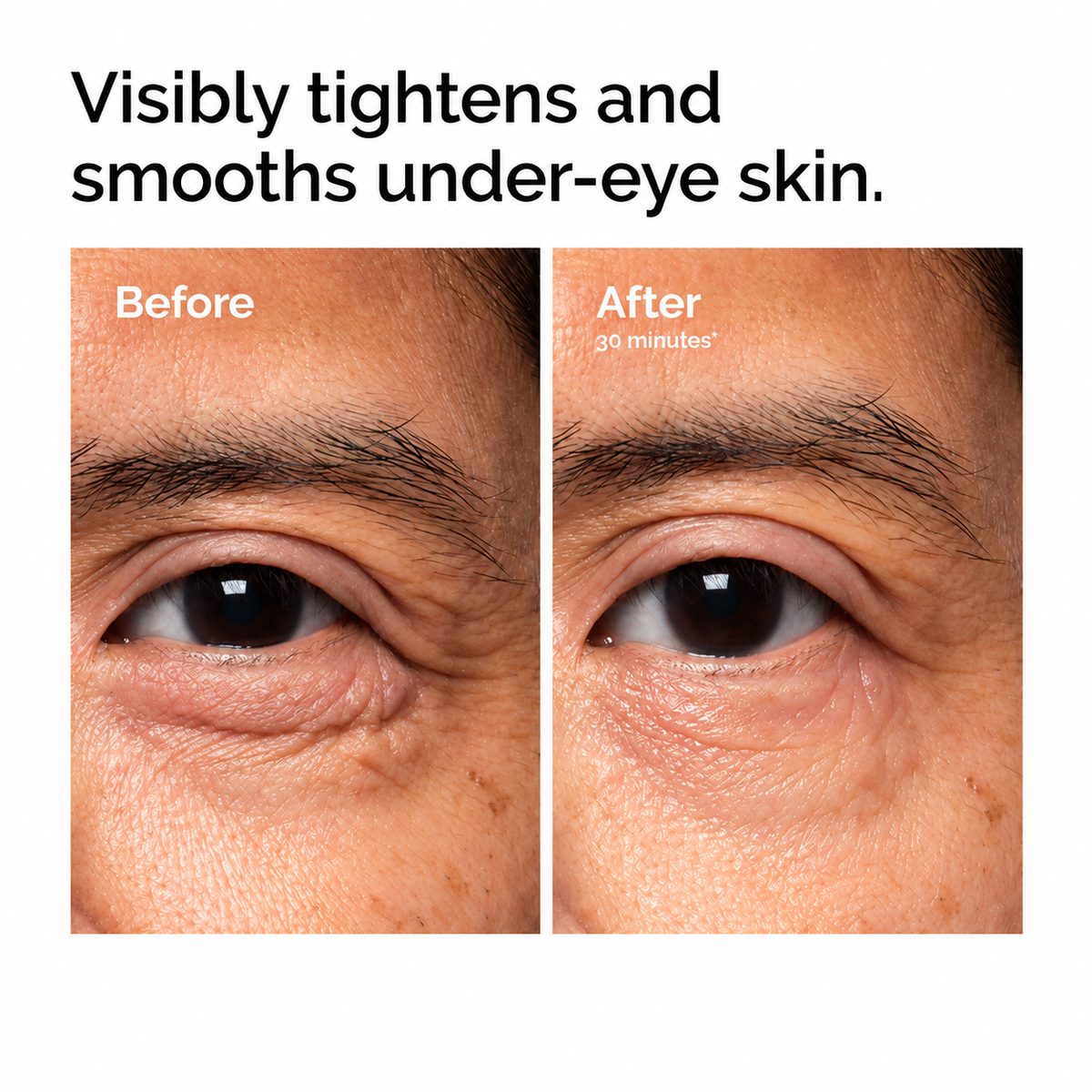 Excalvo PDRN Eye Cream