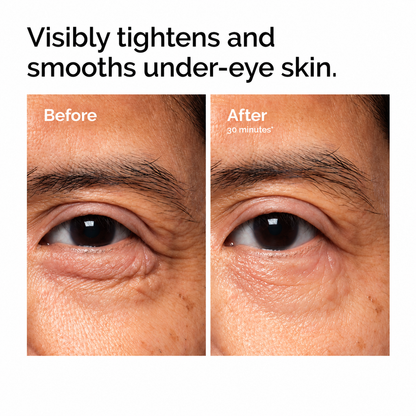 Excalvo PDRN Eye Cream