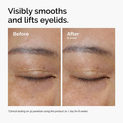 Excalvo PDRN Eye Cream